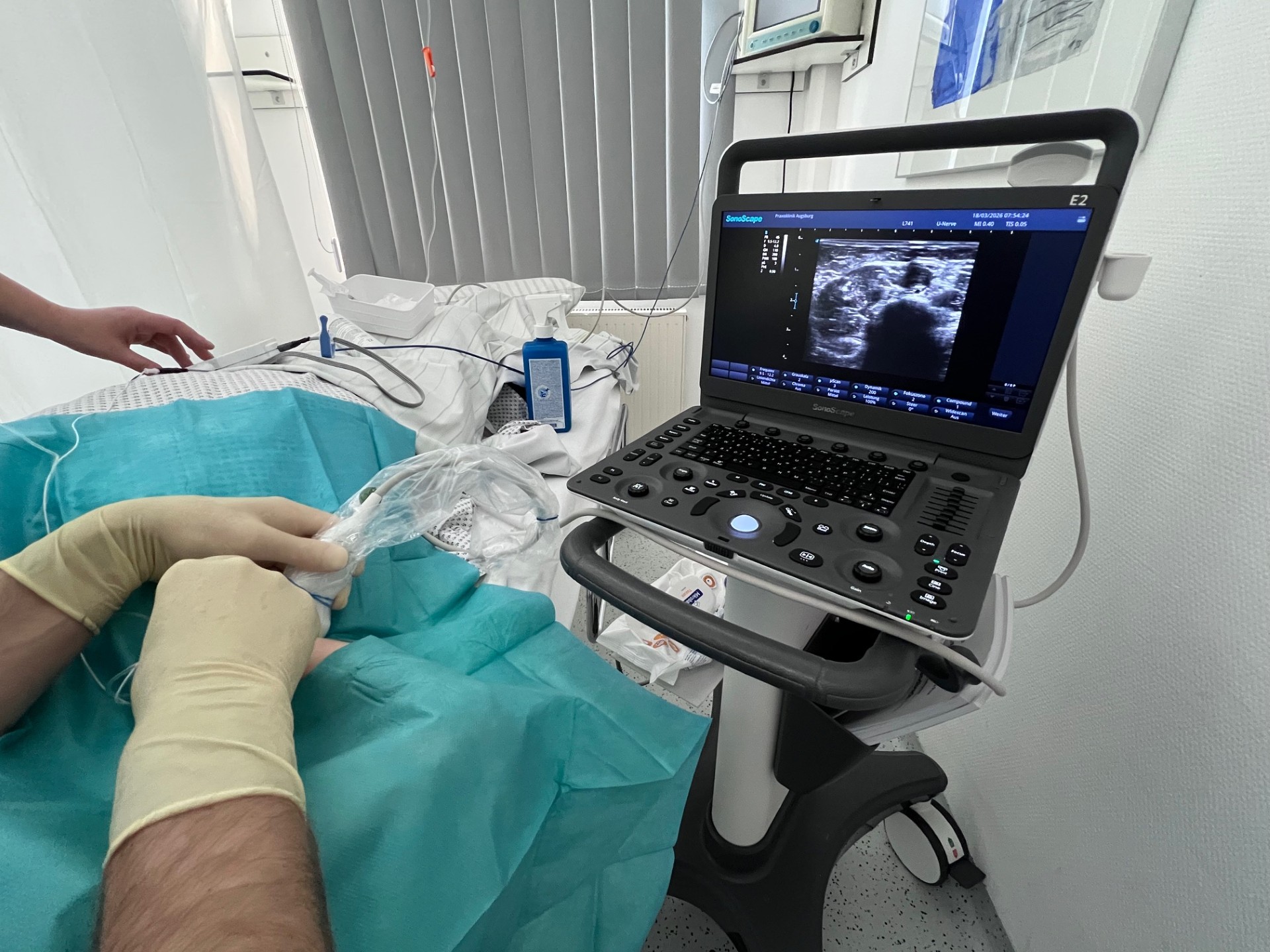 Regionalanaesthesie